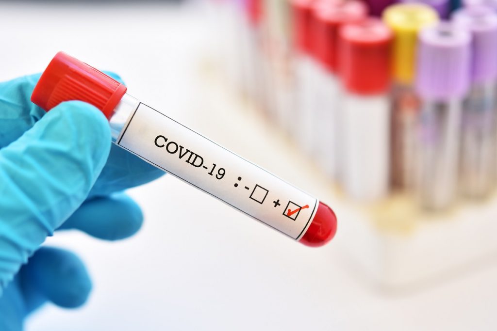 41 girls test Covid positive in SC & ST Girls High School in Rayagada