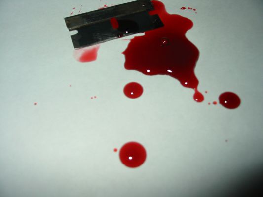 ହାଜତରେ ବେକ ଓ ହାତ କାଟି ଆତ୍ମହତ୍ୟା ଉଦ୍ୟମ