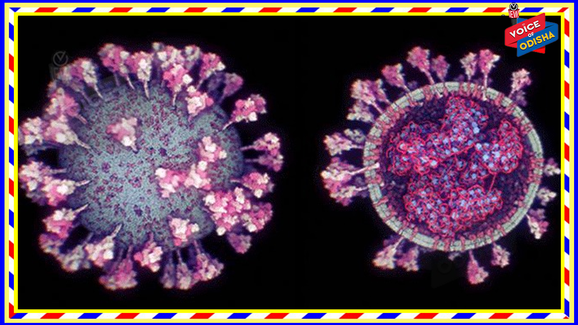 କରୋନା ଦ୍ୱିତୀୟ ଢେଉ : ରାଜ୍ୟରେ କରୋନାରୁ ଆଉ ୧୭୪୦ କରୋନା ଆକ୍ରାନ୍ତ ସୁସ୍ଥ