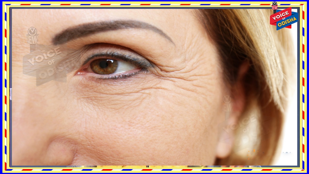 ରିଙ୍କଲ୍ସ ଦୂର କରିବ ନଡିଆ ତେଲ