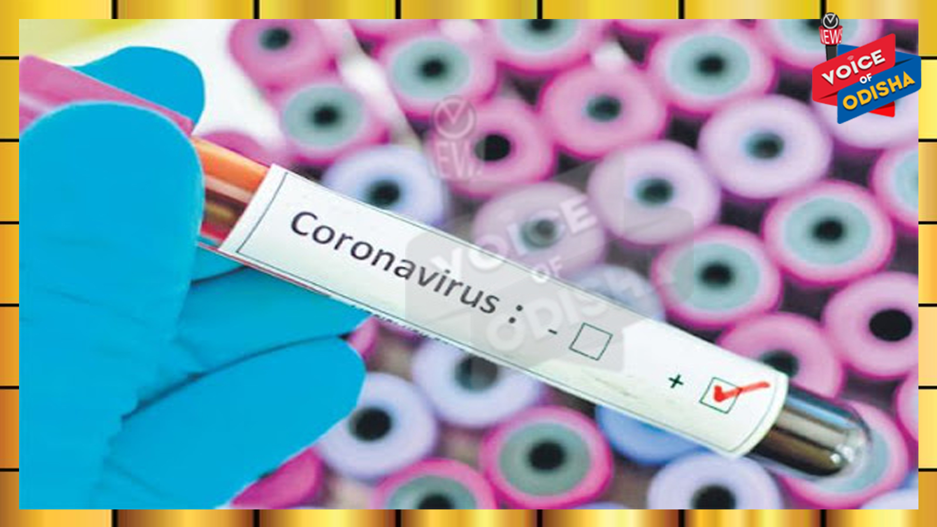 ରାଜ୍ୟରେ ଆଜି ୧୦ ହଜାର ୭୮୧ ଜଣ ହେଲେ ସୁସ୍ଥ