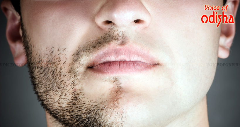 ବିନା ଦାଢ଼ି ଦିବସ