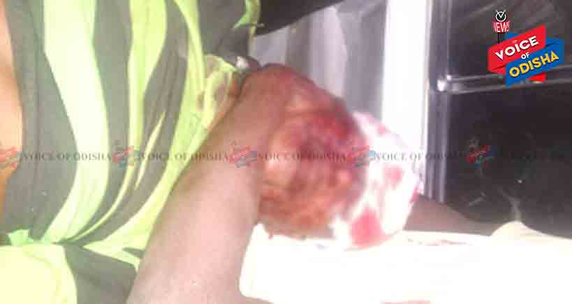 ଅଜଣା ଗାଡି ଧକ୍କା ରେ ବାଇକ ଆରୋହୀ ଗୁରୁତର