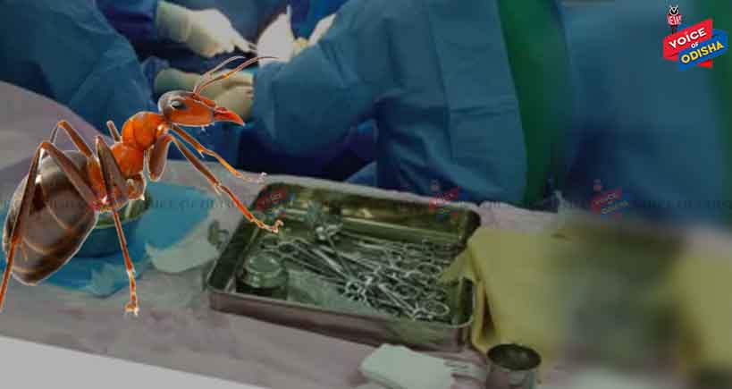 ଅସ୍ତ୍ରୋପଚାର କରିବ ପିମ୍ପୁଡ଼ି  