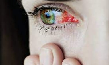 ଆଖି ଧରିଲେ ସ୍କୁଲ ନ ଯିବାକୁ ପରାମର୍ଶ