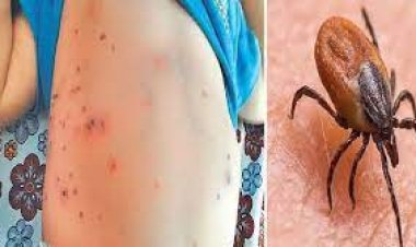 ସ୍କ୍ରବ ଟାଇଫସ: ସୁନ୍ଦରଗଡ଼ରେ ପୁଣି ୫ ଆକ୍ରାନ୍ତ ଚିହ୍ନଟ
