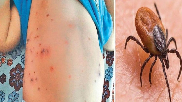 Odisha Govt On Alert Mode After Scrub Typhus Kills 5 People