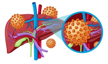 world hepatitis day   