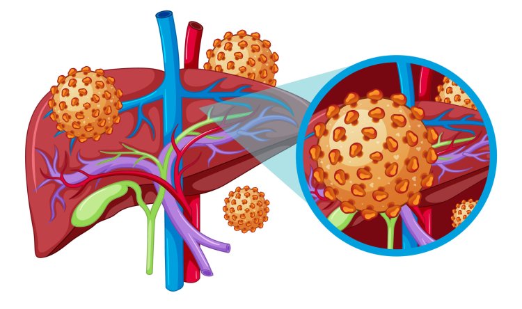 world hepatitis day   